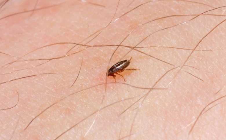Kočičí blecha na lidské kůži s vlasy