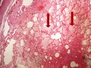 Histologický příčný řez plicí psa s výrazným otokem