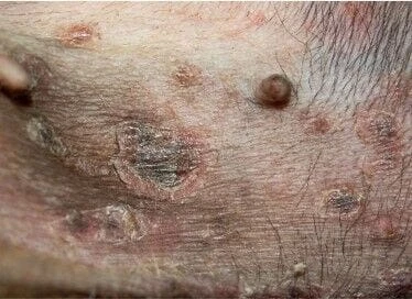 Přiblížený pohled na podrážděnou kůži psa s lupy a vypadávající srstí.